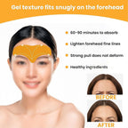 Forehead Wrinkle Patches (10 Pcs) Anti-Aging Pads | GlowForm - Detail View 7