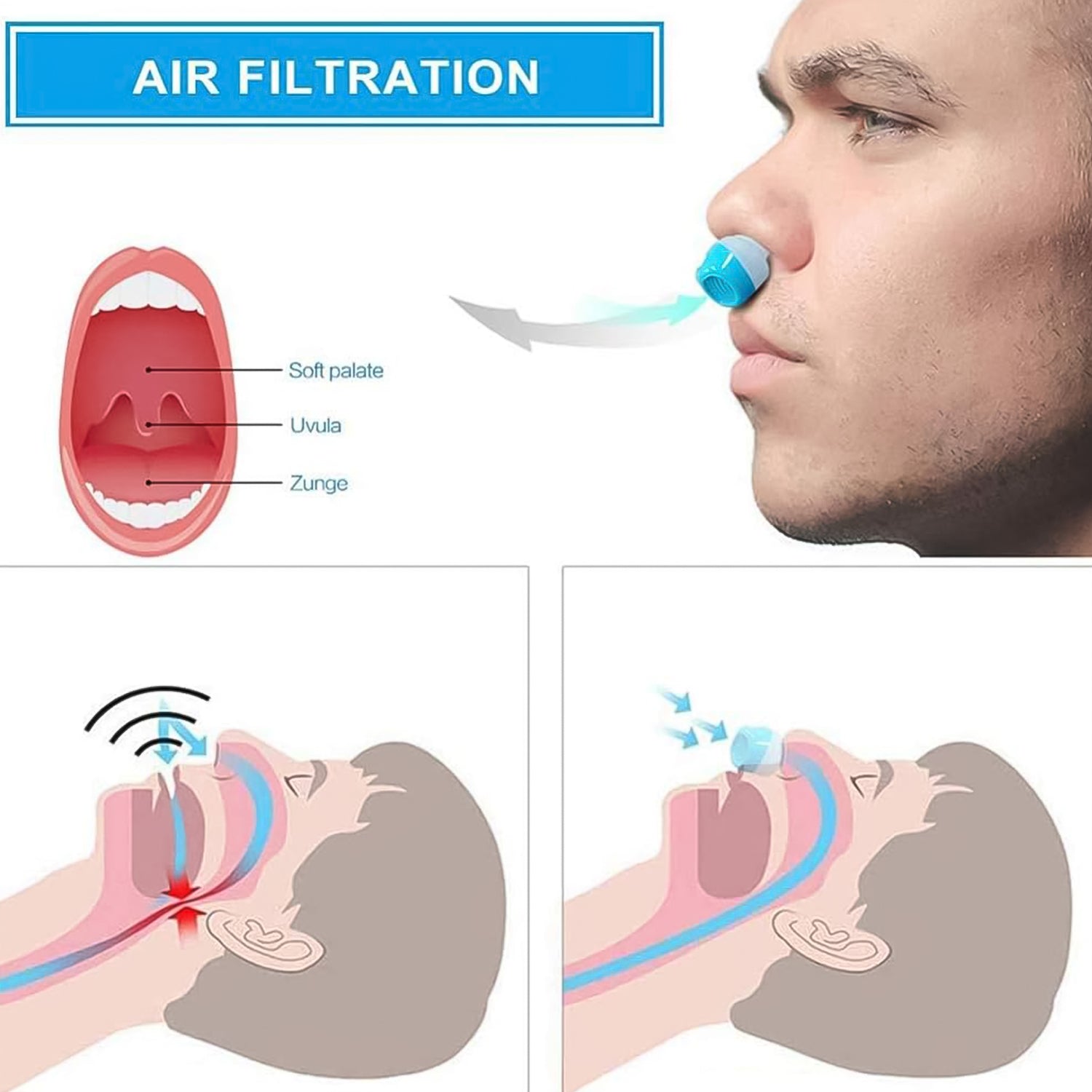 Anti-Snoring Nose Clip 2-in-1 Air Purifier Device - Front View