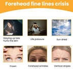 Forehead Wrinkle Patches (10 Pcs) Anti-Aging Pads | GlowForm - Back View