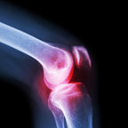 Knee Cap for Support – Large Size for Joint Relief | Velvet Wellness