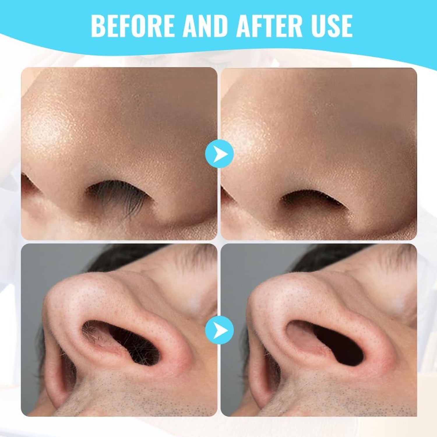 Nose Hair Trimmer Painless 3-in-1 Grooming Kit | PureBeard - Detail View 7