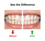 Water Flosser – Portable Smart Device for Gum Health | Velvet Wipe