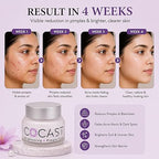 Brightening & Pimple Care Face Cream – Daily Skin Nourishment for Radiance