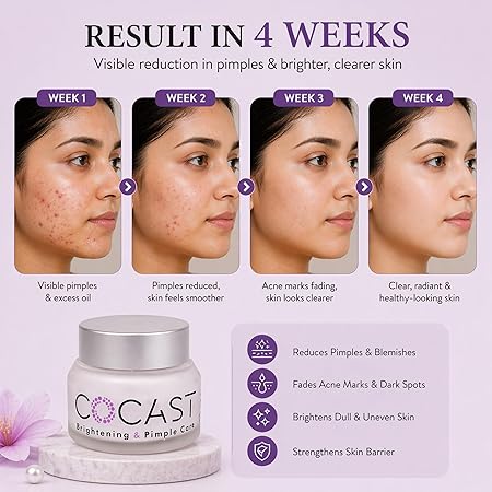 Brightening & Pimple Care Face Cream – Daily Skin Nourishment for Radiance