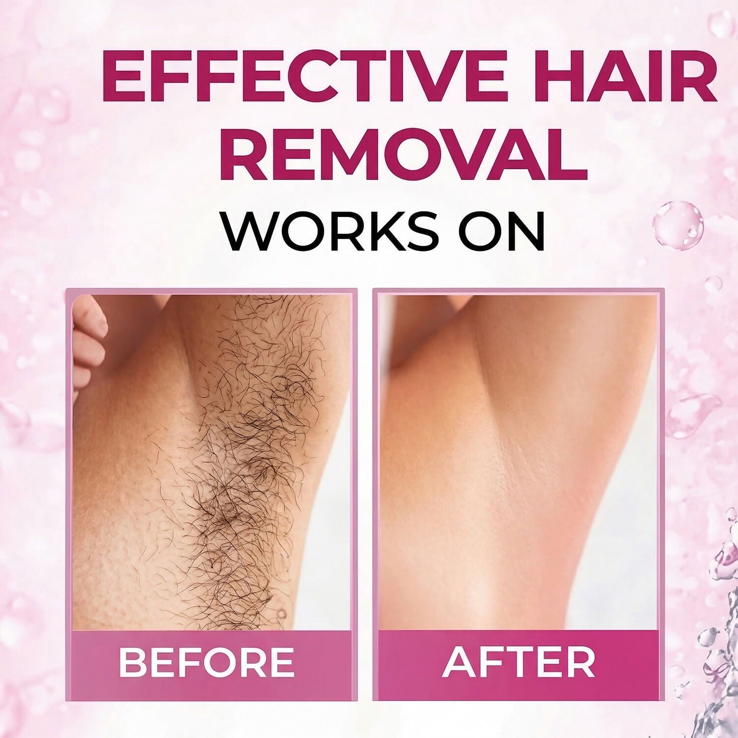 Hair Removal Spray – Painless & Quick with Aloe Vera Formula