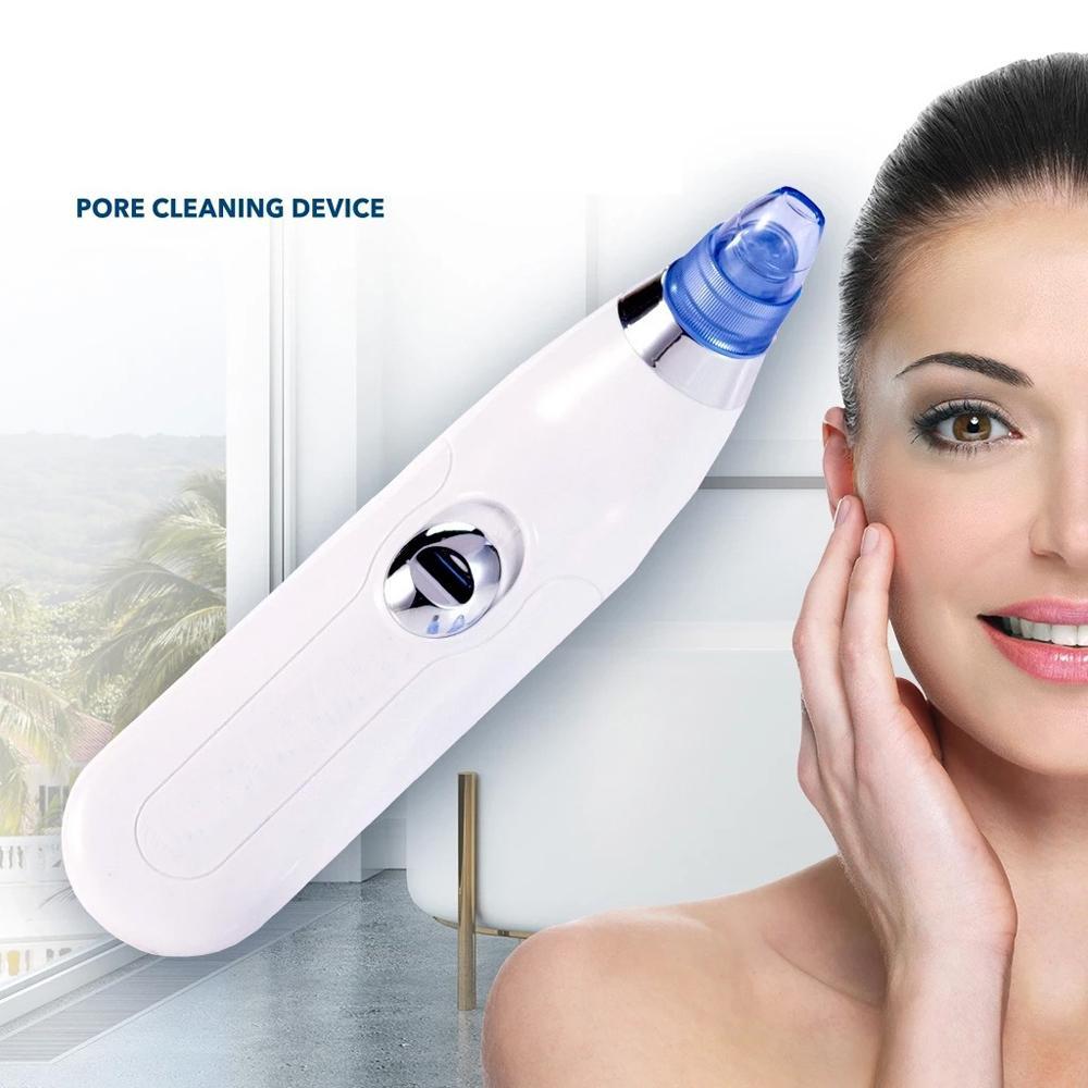  Blackhead Remover – 4-in-1 Vacuum Suction Pore Cleaner | ALVENZA - Detail 1